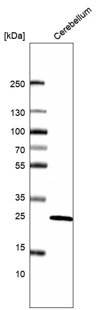 Calbindin D-28K Antibody (CL15059) - Azide and BSA Free Western Blot: Calbindin D-28K Antibody [NBP3-44160]