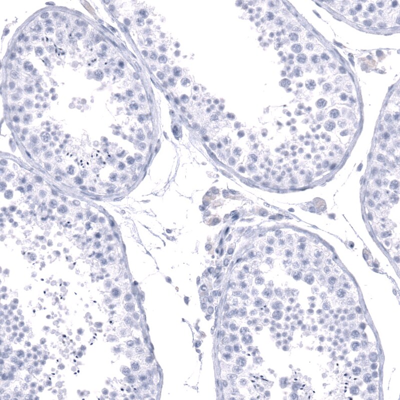 Calbindin D-28K Antibody (CL15059) - Azide and BSA Free Immunohistochemistry-Paraffin: Calbindin D-28K Antibody [NBP3-44160]