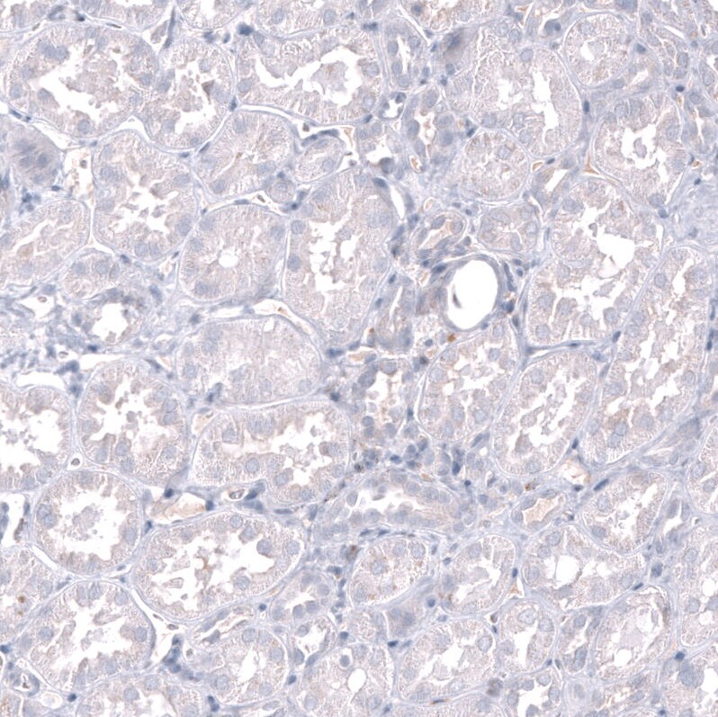 Inhibin beta A Antibody (CL15357) - Azide and BSA Free Immunohistochemistry-Paraffin: Inhibin beta A Antibody [NBP3-44161]