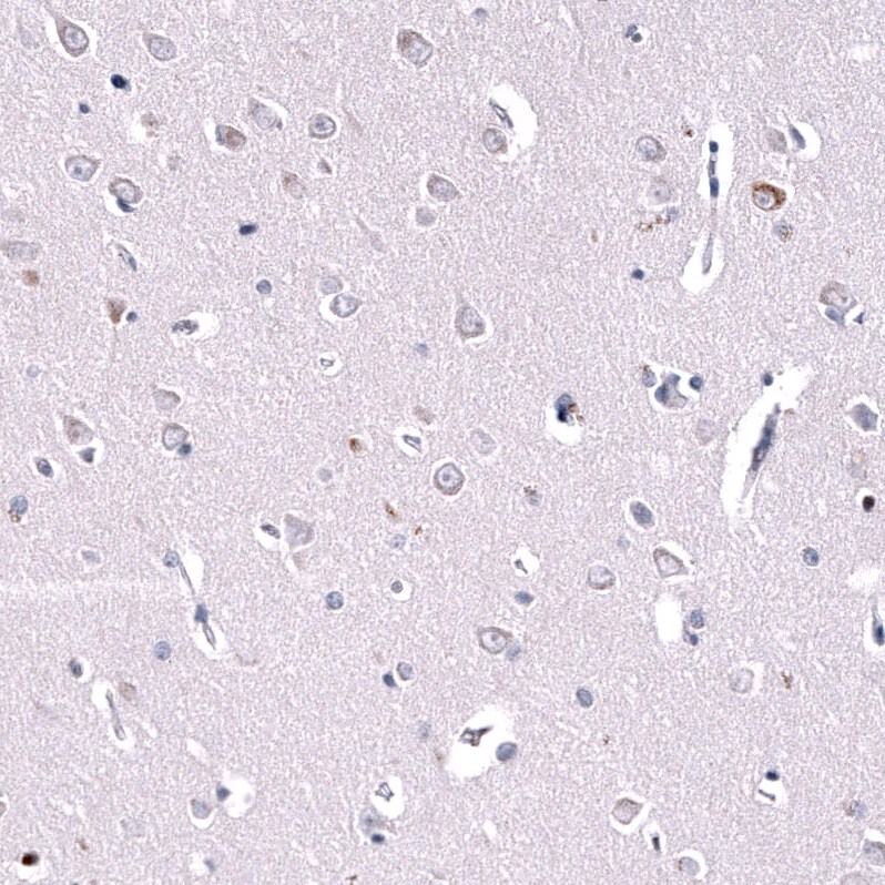 Inhibin beta A Antibody (CL15357) - Azide and BSA Free Immunohistochemistry-Paraffin: Inhibin beta A Antibody [NBP3-44161]