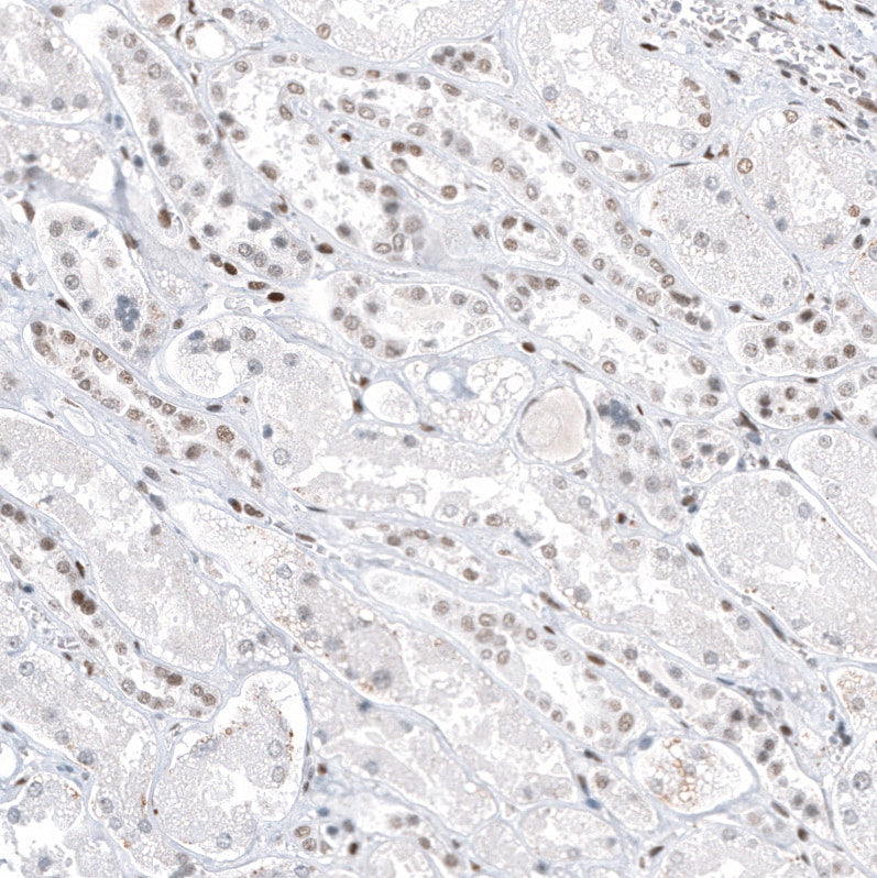 Transcription factor E3 Antibody (CL12822) - Azide and BSA Free Immunohistochemistry-Paraffin: Transcription factor E3 Antibody [NBP3-44162]