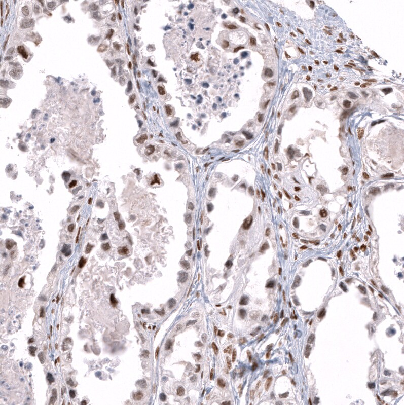 Transcription factor E3 Antibody (CL12822) - Azide and BSA Free Immunohistochemistry-Paraffin: Transcription factor E3 Antibody [NBP3-44162]