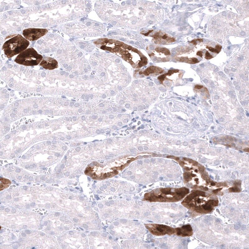 Parvalbumin Antibody (CL15070) - Azide and BSA Free Immunohistochemistry-Paraffin: Parvalbumin Antibody [NBP3-44164]
