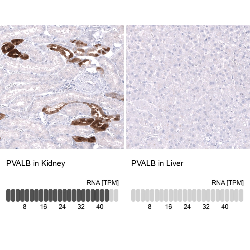 Parvalbumin Antibody (CL15070) - Azide and BSA Free Immunohistochemistry-Paraffin: Parvalbumin Antibody [NBP3-44164]