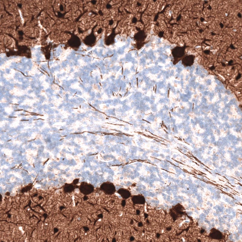 Parvalbumin Antibody (CL15070) - Azide and BSA Free Immunohistochemistry-Paraffin: Parvalbumin Antibody [NBP3-44164]