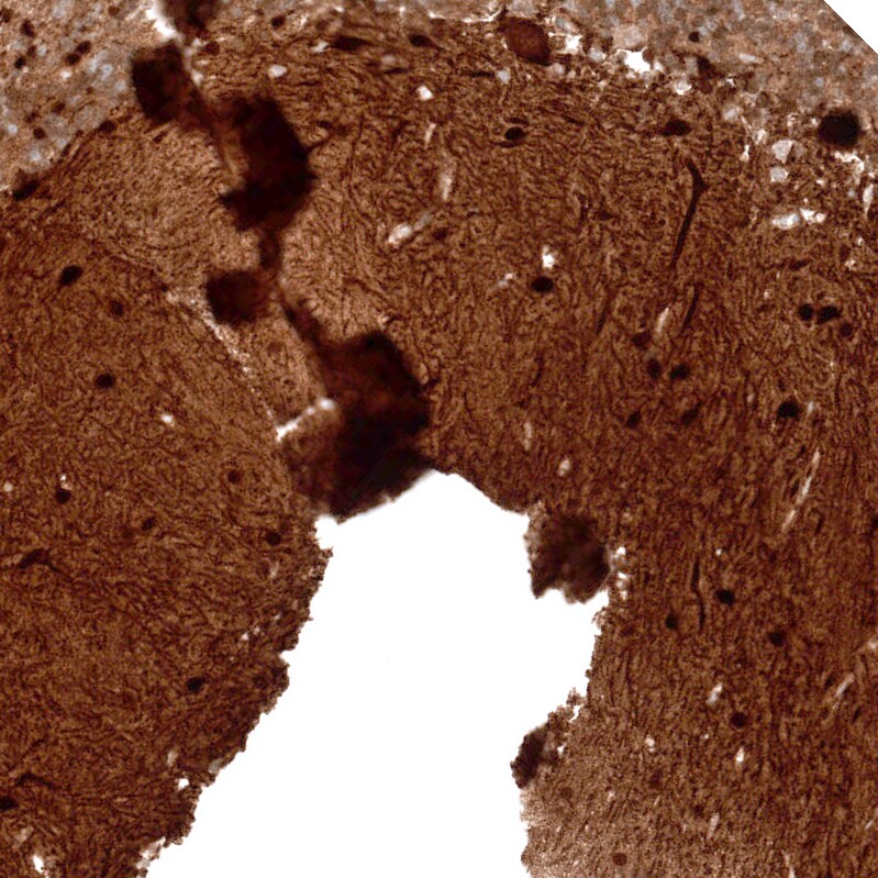 Parvalbumin Antibody (CL15072) - Azide and BSA Free Immunohistochemistry-Paraffin: Parvalbumin Antibody [NBP3-44165]