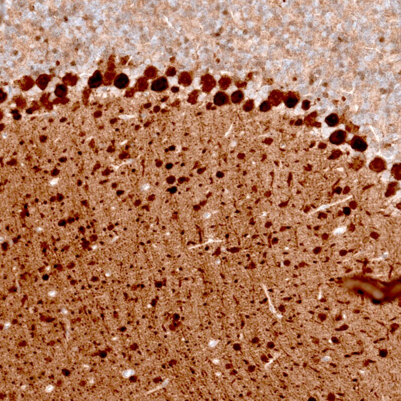 Parvalbumin Antibody (CL15073) - Azide and BSA Free Immunohistochemistry-Paraffin: Parvalbumin Antibody [NBP3-44166]