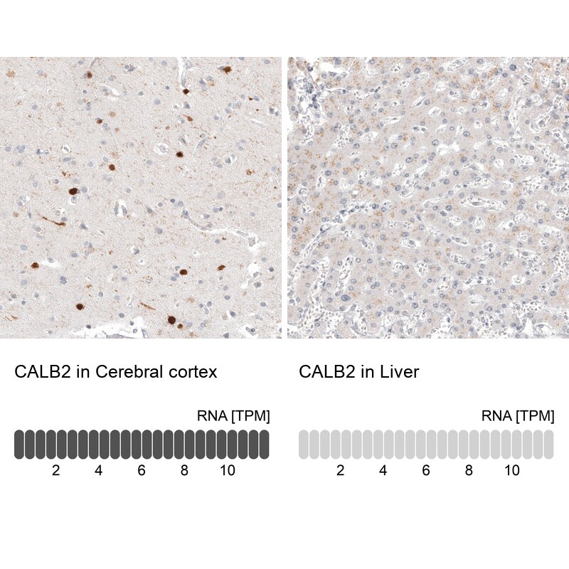 Calretinin Antibody (CL12842) - Azide and BSA Free Immunohistochemistry-Paraffin: Calretinin Antibody [NBP3-44167]