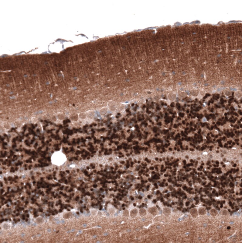 Calretinin Antibody (CL12842) - Azide and BSA Free Immunohistochemistry-Paraffin: Calretinin Antibody [NBP3-44167]