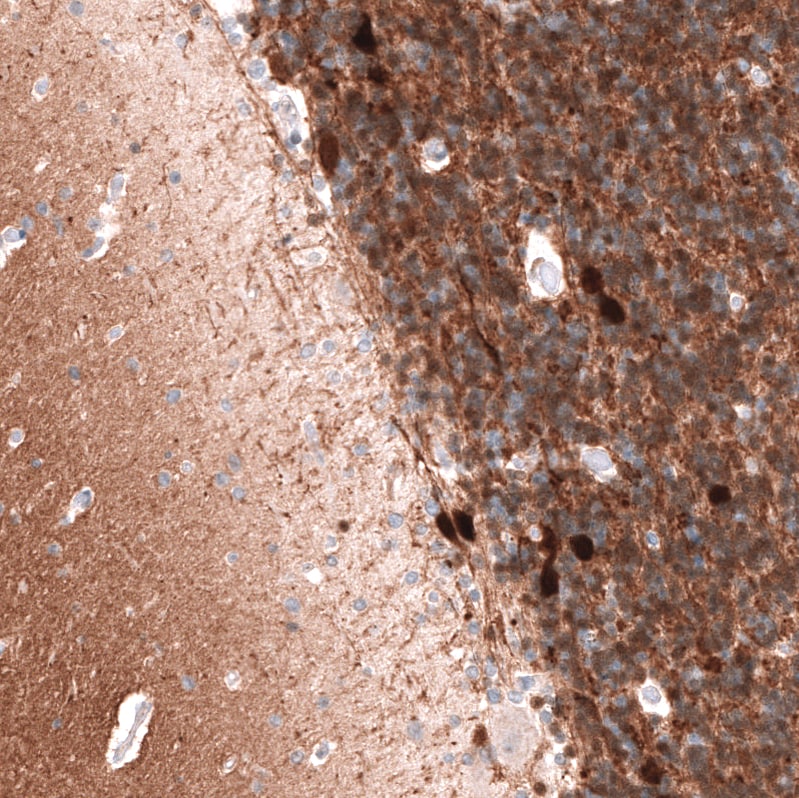 Calretinin Antibody (CL12838) - Azide and BSA Free Immunohistochemistry-Paraffin: Calretinin Antibody [NBP3-44168]