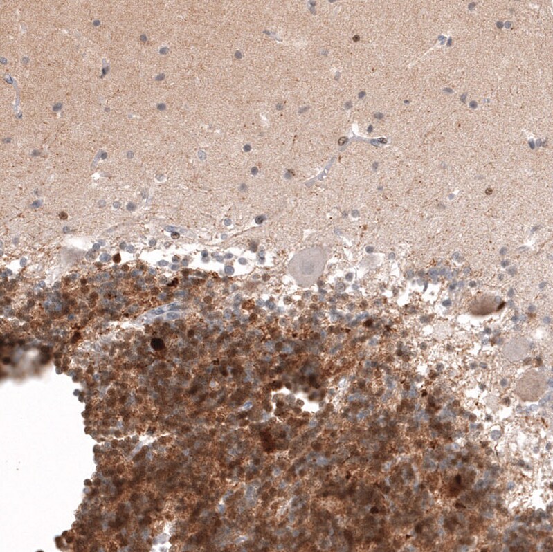 Calretinin Antibody (CL12836) - Azide and BSA Free Immunohistochemistry-Paraffin: Calretinin Antibody [NBP3-44169]