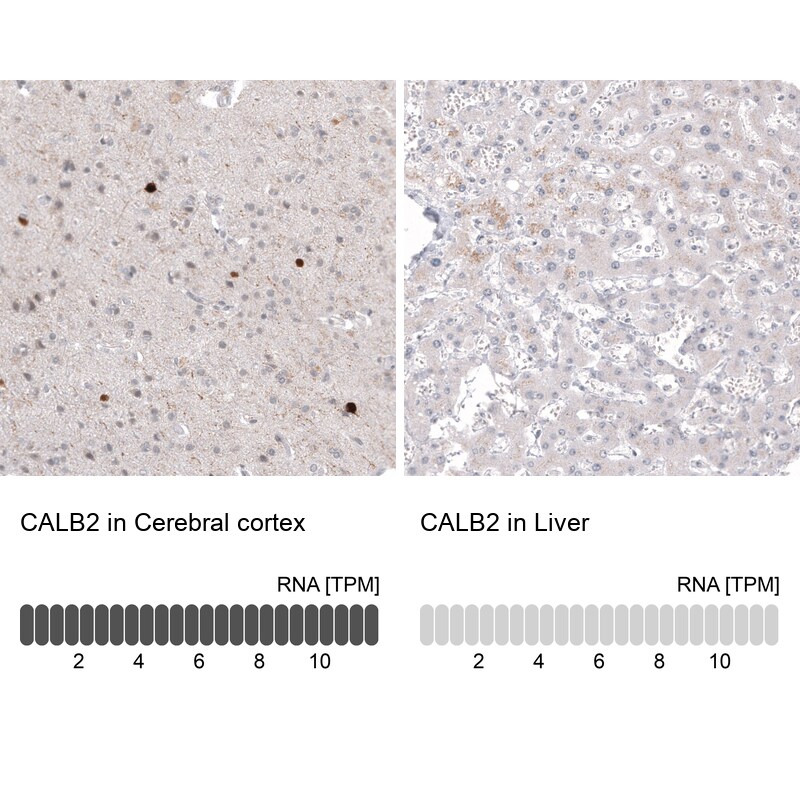 Calretinin Antibody (CL12836) - Azide and BSA Free Immunohistochemistry-Paraffin: Calretinin Antibody [NBP3-44169]