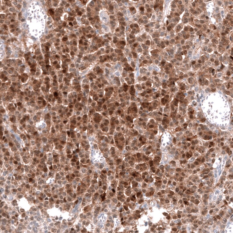 Calretinin Antibody (CL12836) - Azide and BSA Free Immunohistochemistry-Paraffin: Calretinin Antibody [NBP3-44169]
