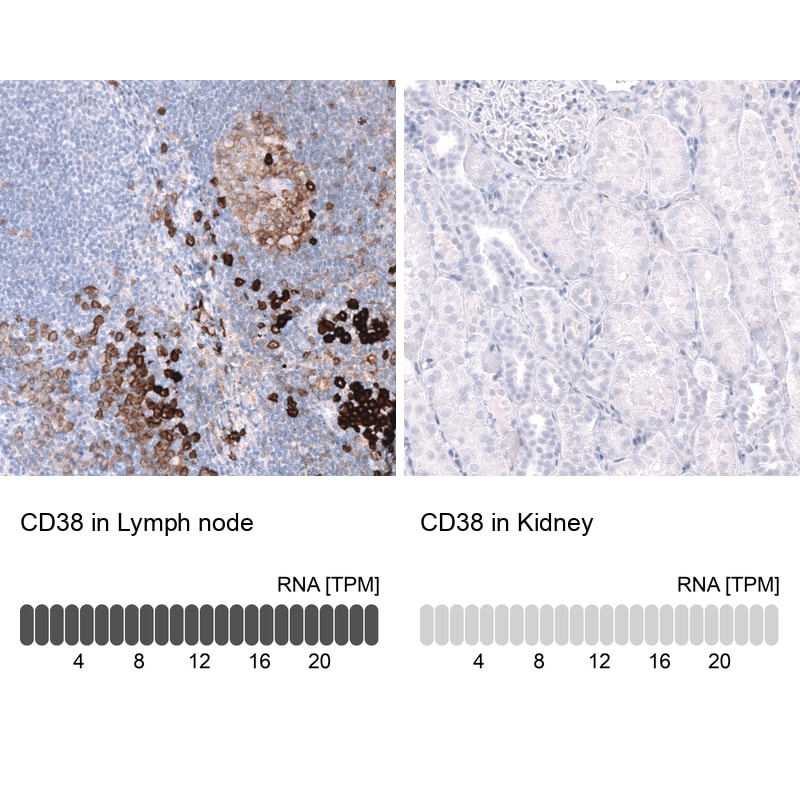 CD38 Antibody (CL15572) - Azide and BSA Free Immunohistochemistry-Paraffin: CD38 Antibody [NBP3-44170]