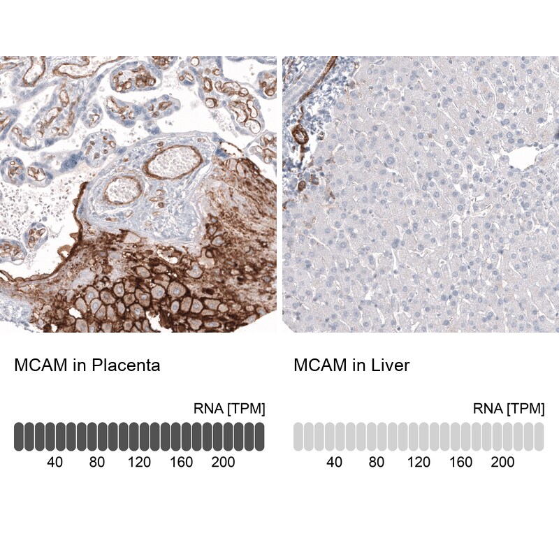 MCAM/CD146 Antibody (CL12855) - Azide and BSA Free Immunohistochemistry-Paraffin: MCAM/CD146 Antibody [NBP3-44171]
