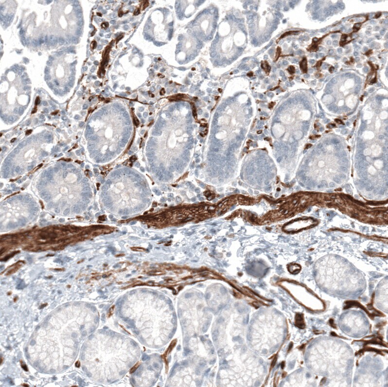 MCAM/CD146 Antibody (CL12855) - Azide and BSA Free Immunohistochemistry-Paraffin: MCAM/CD146 Antibody [NBP3-44171]