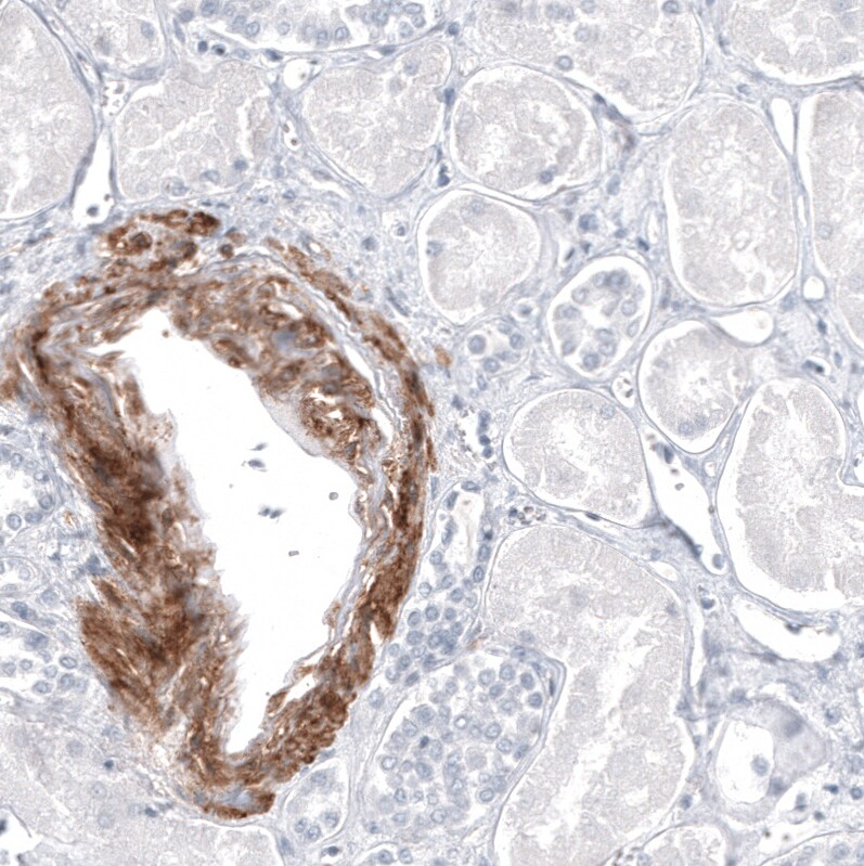 MCAM/CD146 Antibody (CL12855) - Azide and BSA Free Immunohistochemistry-Paraffin: MCAM/CD146 Antibody [NBP3-44171]