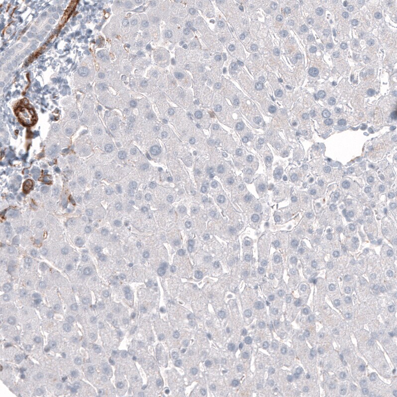 MCAM/CD146 Antibody (CL12855) - Azide and BSA Free Immunohistochemistry-Paraffin: MCAM/CD146 Antibody [NBP3-44171]