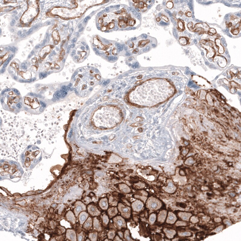 MCAM/CD146 Antibody (CL12855) - Azide and BSA Free Immunohistochemistry-Paraffin: MCAM/CD146 Antibody [NBP3-44171]