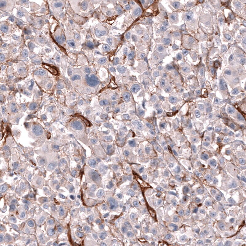 MCAM/CD146 Antibody (CL12855) - Azide and BSA Free Immunohistochemistry-Paraffin: MCAM/CD146 Antibody [NBP3-44171]