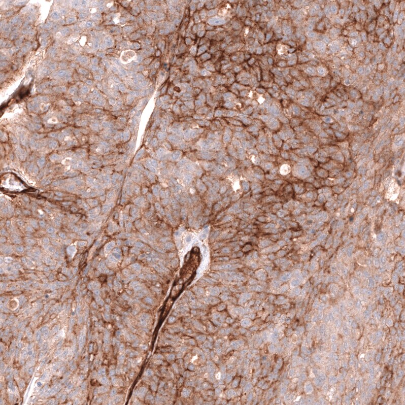 MCAM/CD146 Antibody (CL12855) - Azide and BSA Free Immunohistochemistry-Paraffin: MCAM/CD146 Antibody [NBP3-44171]