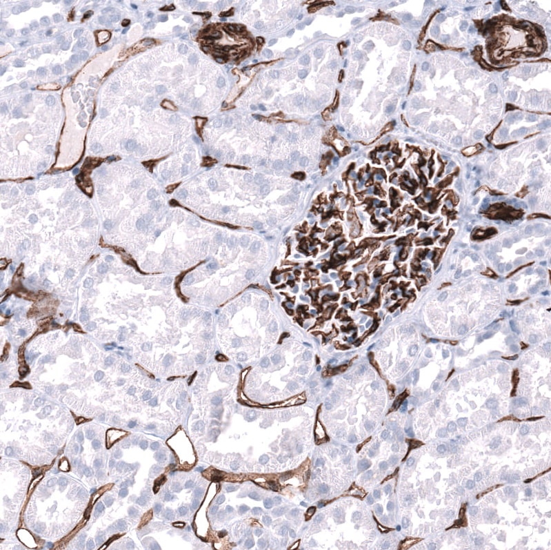 Cadherin-13 Antibody (CL15368) - Azide and BSA Free Immunohistochemistry-Paraffin: Cadherin-13 Antibody [NBP3-44172]