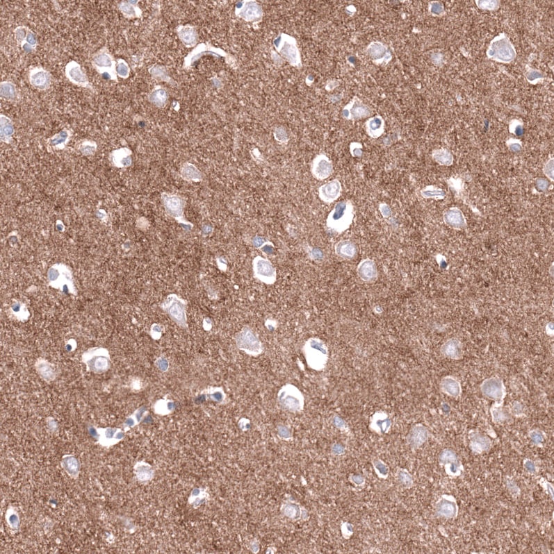 Cadherin-13 Antibody (CL15368) - Azide and BSA Free Immunohistochemistry-Paraffin: Cadherin-13 Antibody [NBP3-44172]