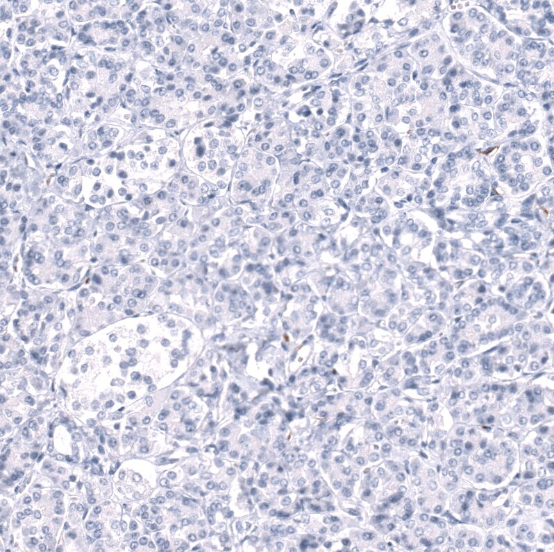 Cadherin-13 Antibody (CL15368) - Azide and BSA Free Immunohistochemistry-Paraffin: Cadherin-13 Antibody [NBP3-44172]