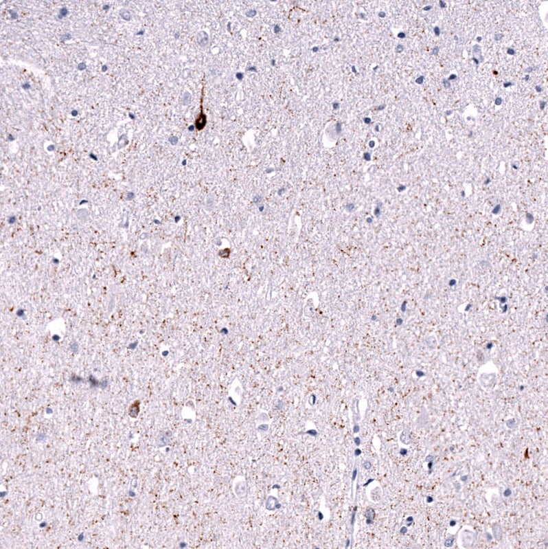 Somatostatin Antibody (CL15076) - Azide and BSA Free Immunohistochemistry-Paraffin: Somatostatin Antibody [NBP3-44173]