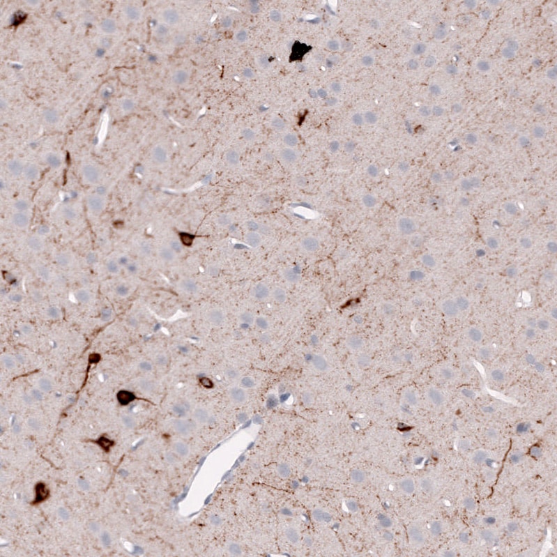 Somatostatin Antibody (CL15076) - Azide and BSA Free Immunohistochemistry-Paraffin: Somatostatin Antibody [NBP3-44173]