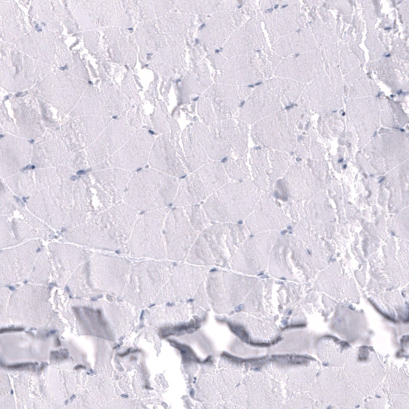 Somatostatin Antibody (CL15076) - Azide and BSA Free Immunohistochemistry-Paraffin: Somatostatin Antibody [NBP3-44173]