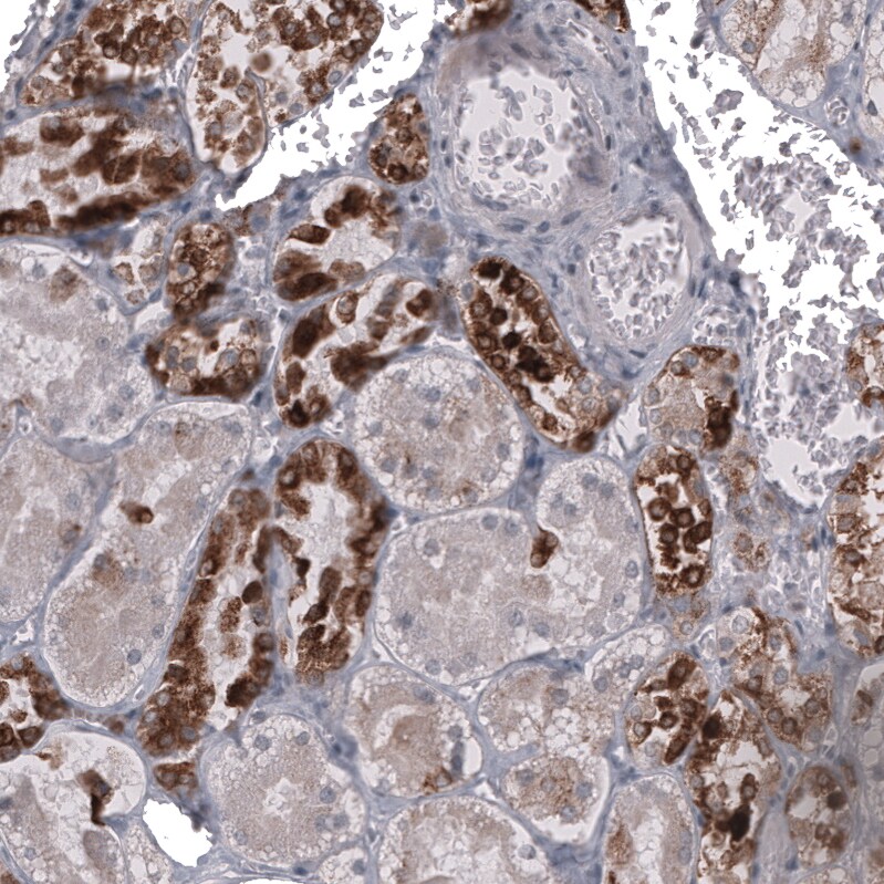 HE4/WFDC2 Antibody (CL12917) - Azide and BSA Free Immunohistochemistry-Paraffin: HE4/WFDC2 Antibody [NBP3-44175]