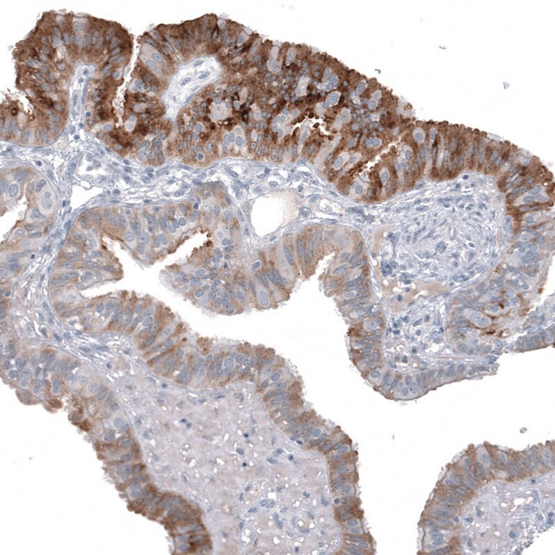 HE4/WFDC2 Antibody (CL12917) - Azide and BSA Free Immunohistochemistry-Paraffin: HE4/WFDC2 Antibody [NBP3-44175]