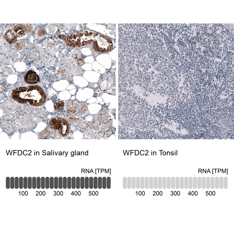 HE4/WFDC2 Antibody (CL12917) - Azide and BSA Free Immunohistochemistry-Paraffin: HE4/WFDC2 Antibody [NBP3-44175]