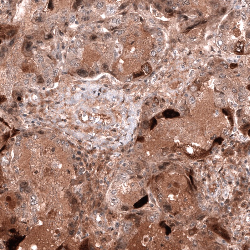 HE4/WFDC2 Antibody (CL12917) - Azide and BSA Free Immunohistochemistry-Paraffin: HE4/WFDC2 Antibody [NBP3-44175]