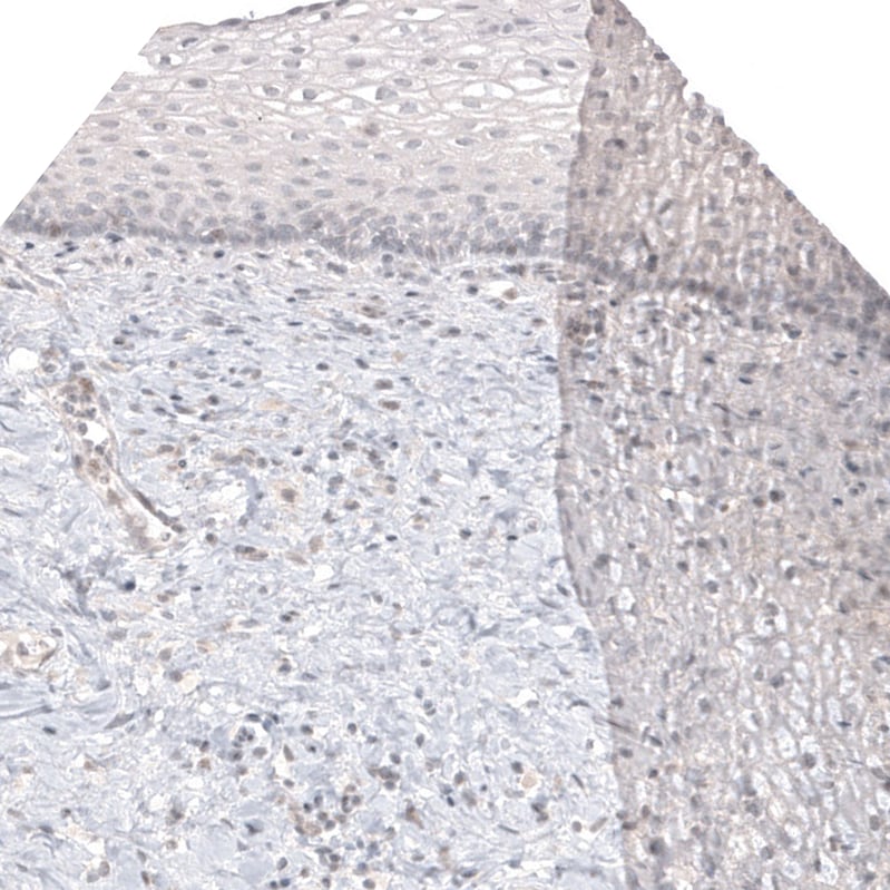 Melan-A/MART-1 Antibody (CL12874) - Azide and BSA Free Immunohistochemistry-Paraffin: Melan-A/MART-1 Antibody [NBP3-44176]