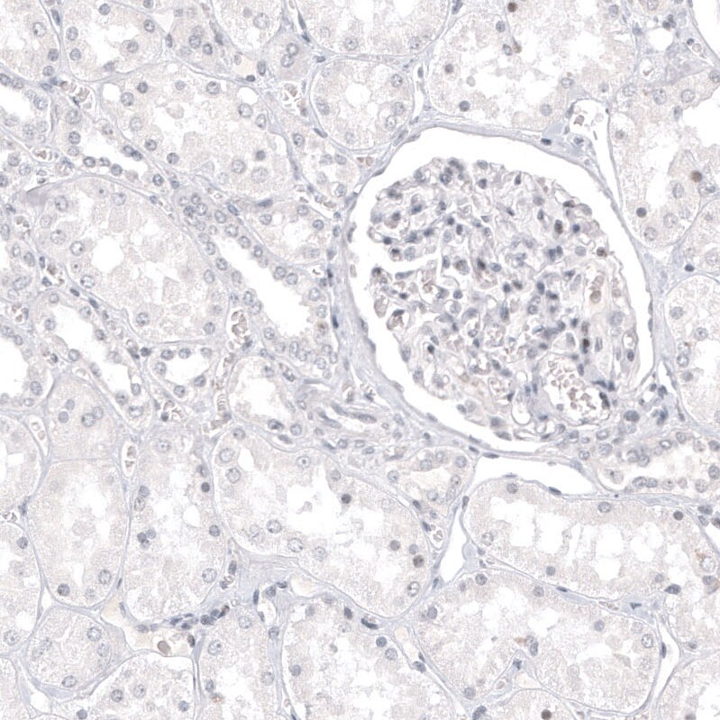 Melan-A/MART-1 Antibody (CL12874) - Azide and BSA Free Immunohistochemistry-Paraffin: Melan-A/MART-1 Antibody [NBP3-44176]