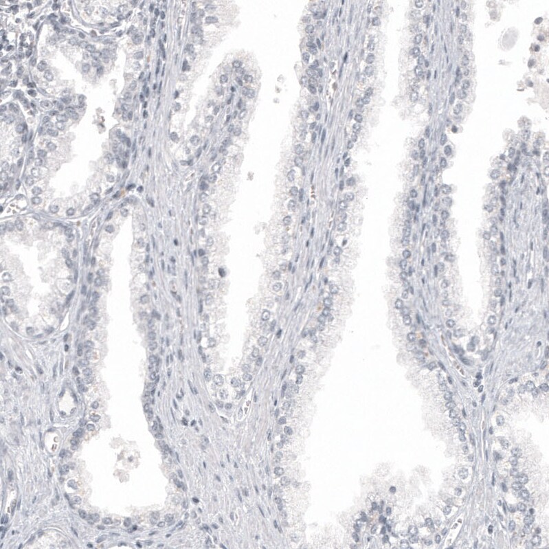 Melan-A/MART-1 Antibody (CL12874) - Azide and BSA Free Immunohistochemistry-Paraffin: Melan-A/MART-1 Antibody [NBP3-44176]