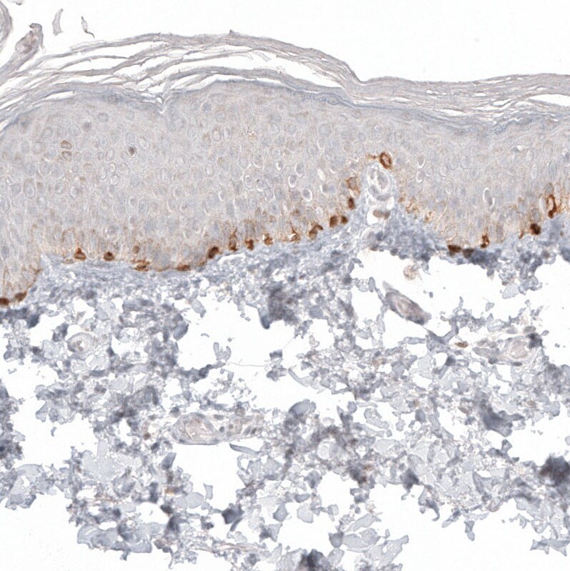 Melan-A/MART-1 Antibody (CL12874) - Azide and BSA Free Immunohistochemistry-Paraffin: Melan-A/MART-1 Antibody [NBP3-44176]