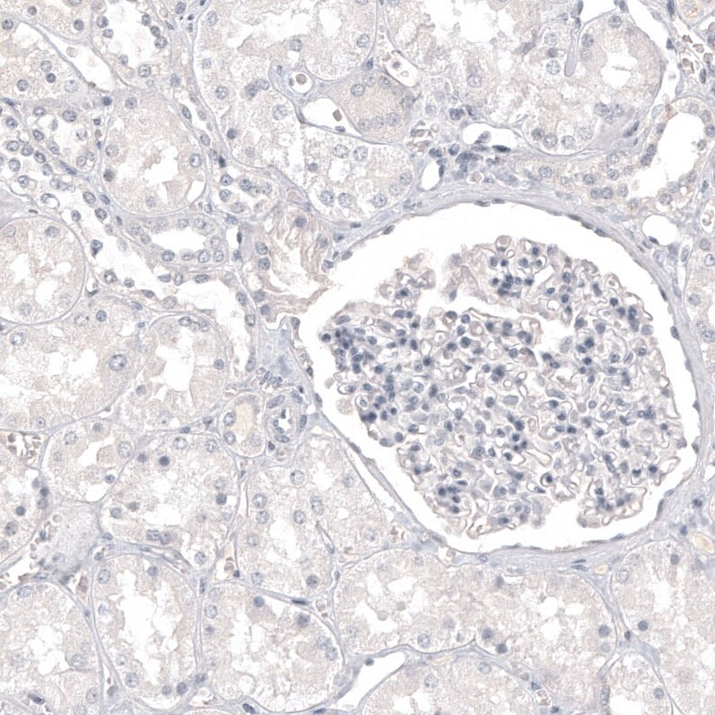 Melan-A/MART-1 Antibody (CL12863) - Azide and BSA Free Immunohistochemistry-Paraffin: Melan-A/MART-1 Antibody [NBP3-44177]