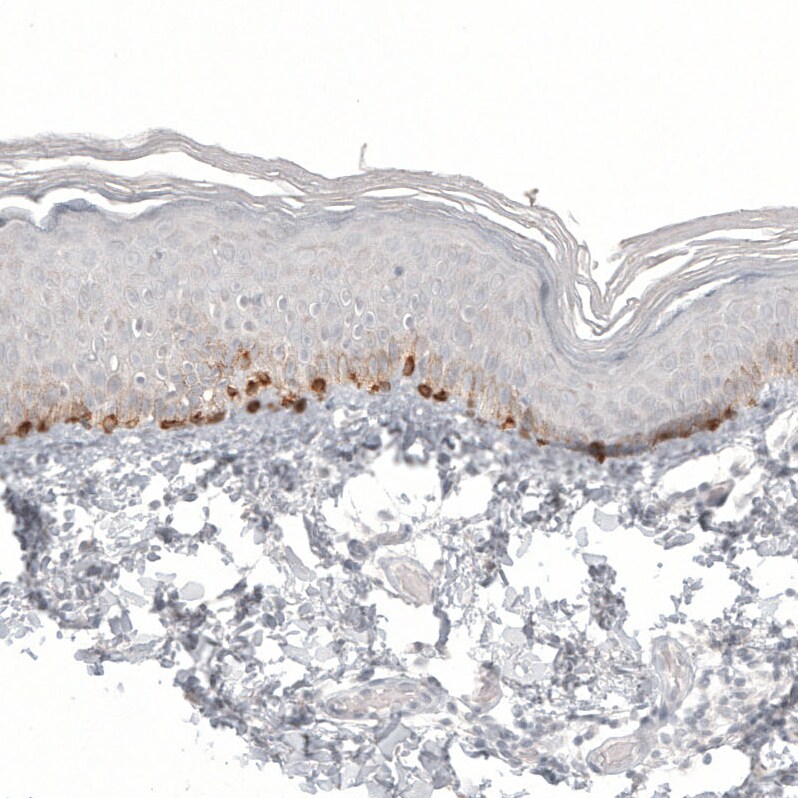 Melan-A/MART-1 Antibody (CL12863) - Azide and BSA Free Immunohistochemistry-Paraffin: Melan-A/MART-1 Antibody [NBP3-44177]