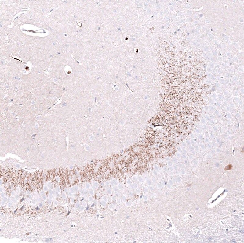 Nectin-3/PVRL3 Antibody (CL15364) - Azide and BSA Free Immunohistochemistry-Paraffin: Nectin-3/PVRL3 Antibody [NBP3-44180]