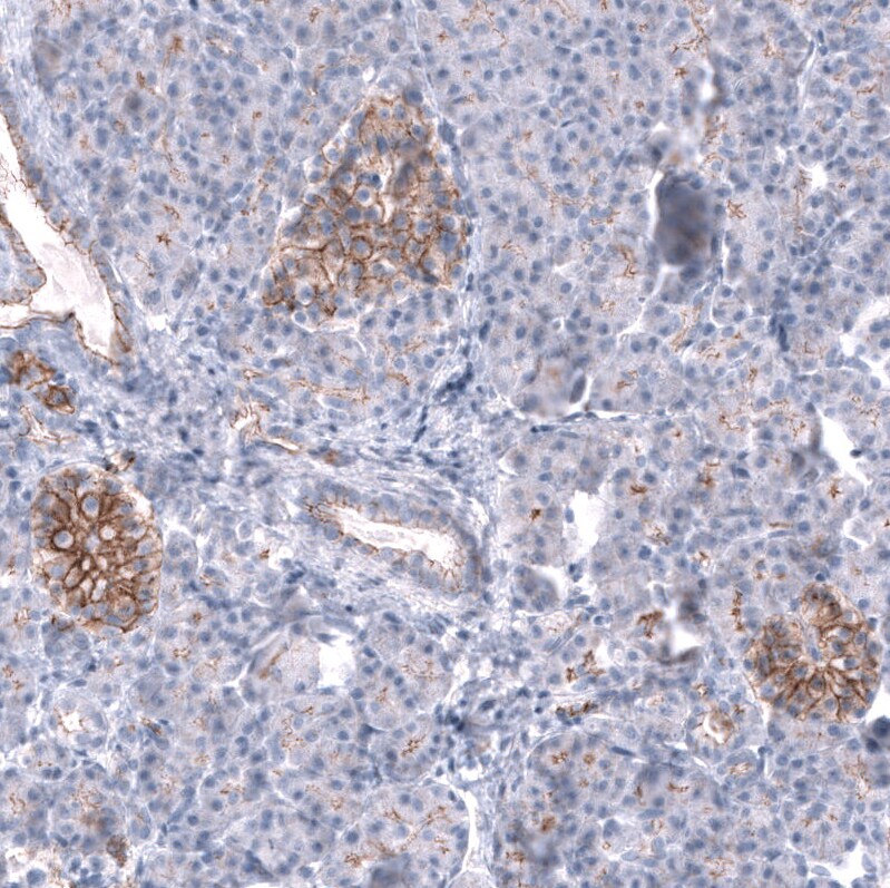 Nectin-3/PVRL3 Antibody (CL15364) - Azide and BSA Free Immunohistochemistry-Paraffin: Nectin-3/PVRL3 Antibody [NBP3-44180]