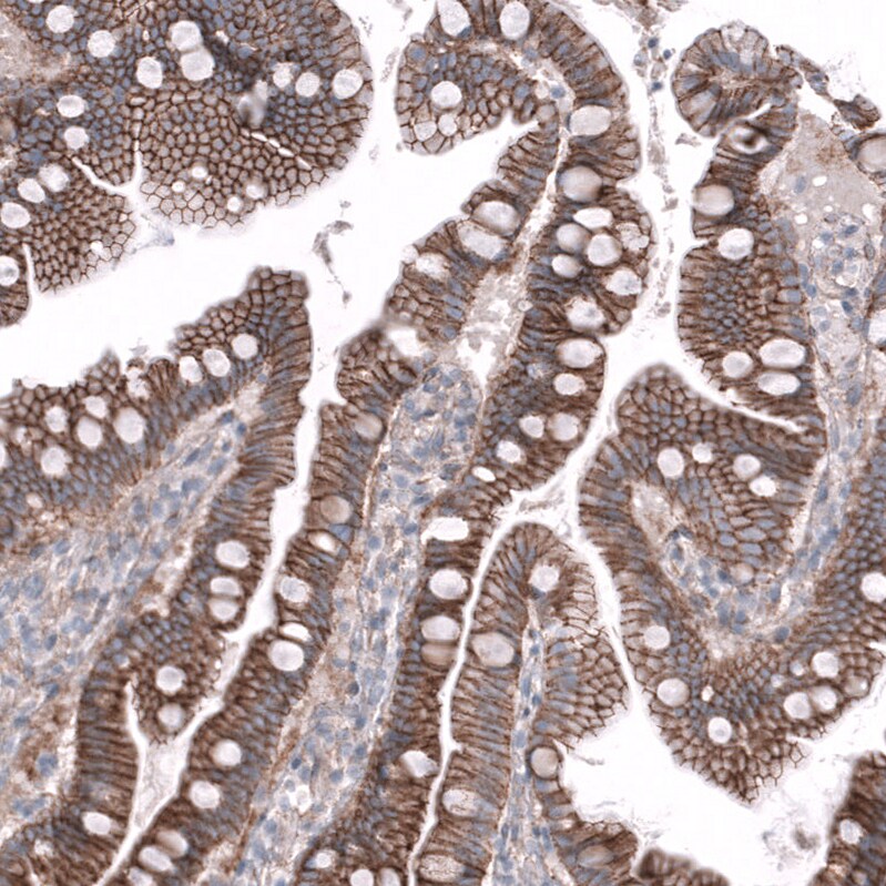 Nectin-3/PVRL3 Antibody (CL15366) - Azide and BSA Free Immunohistochemistry-Paraffin: Nectin-3/PVRL3 Antibody [NBP3-44181]
