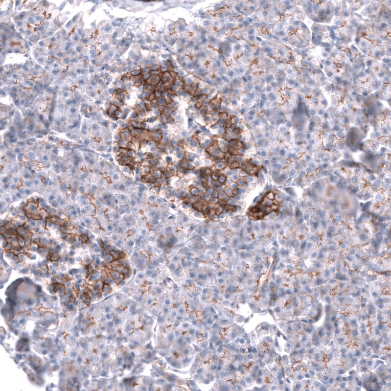 Nectin-3/PVRL3 Antibody (CL15366) - Azide and BSA Free Immunohistochemistry-Paraffin: Nectin-3/PVRL3 Antibody [NBP3-44181]
