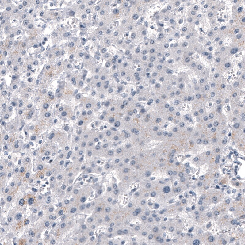 Chromogranin B Antibody (CL11404) - Azide and BSA Free Immunohistochemistry-Paraffin: Chromogranin B Antibody [NBP3-44183]