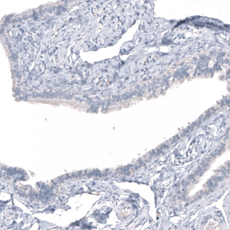 HO-1/HMOX1/HSP32 Antibody (CL11669) - Azide and BSA Free Immunohistochemistry-Paraffin: HO-1/HMOX1/HSP32 Antibody [NBP3-44184]