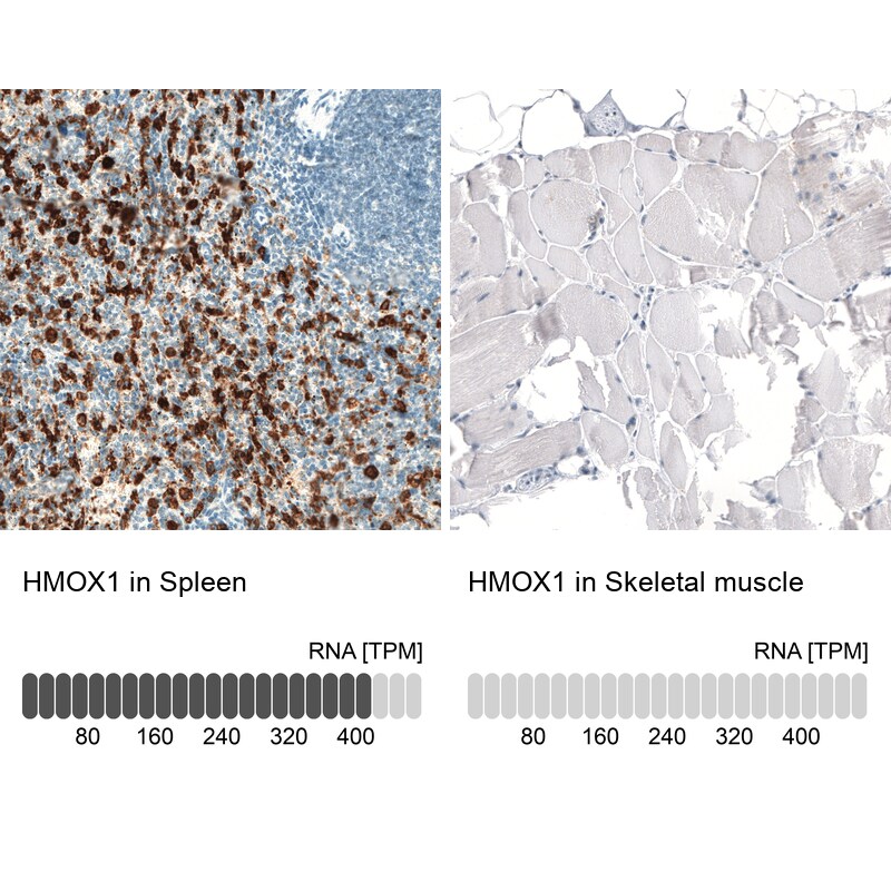 HO-1/HMOX1/HSP32 Antibody (CL11669) - Azide and BSA Free Immunohistochemistry-Paraffin: HO-1/HMOX1/HSP32 Antibody [NBP3-44184]