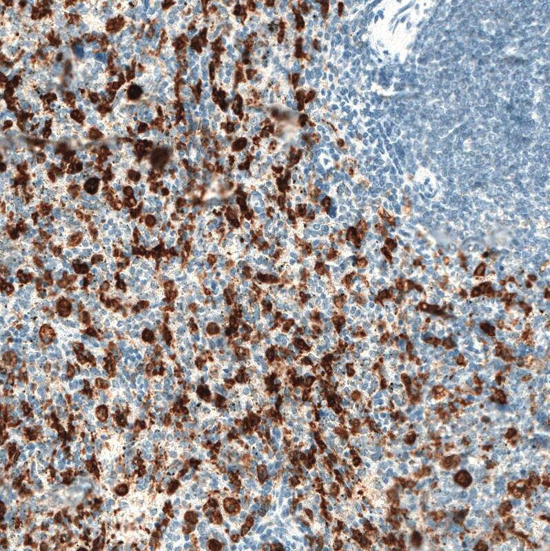 HO-1/HMOX1/HSP32 Antibody (CL11669) - Azide and BSA Free Immunohistochemistry-Paraffin: HO-1/HMOX1/HSP32 Antibody [NBP3-44184]
