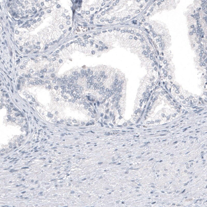 HO-1/HMOX1/HSP32 Antibody (CL11669) - Azide and BSA Free Immunohistochemistry-Paraffin: HO-1/HMOX1/HSP32 Antibody [NBP3-44184]